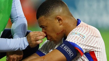 mbappe-tanya-ide-masker-ke-netizen-usai-cedera-horor-di-euro-2024