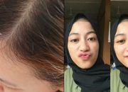 5 Cara Alami Hilangkan Anak Rambut di Dahi yang Suka Berdiri, Biar Tampilan Jadi Lebih Rapi