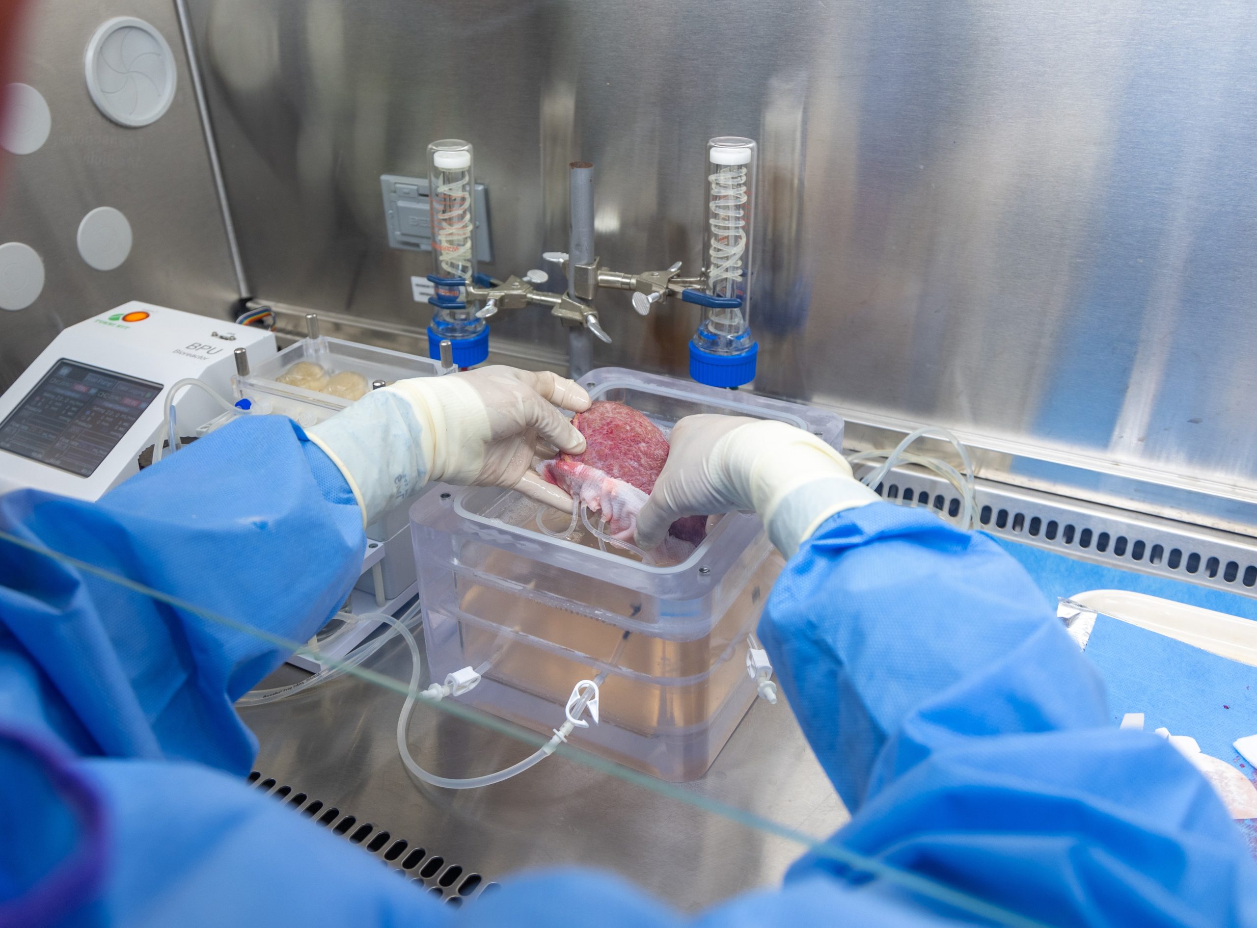 batas-baru-mrna-bisa-jadi-penyembuhan-organ-yang-rusak