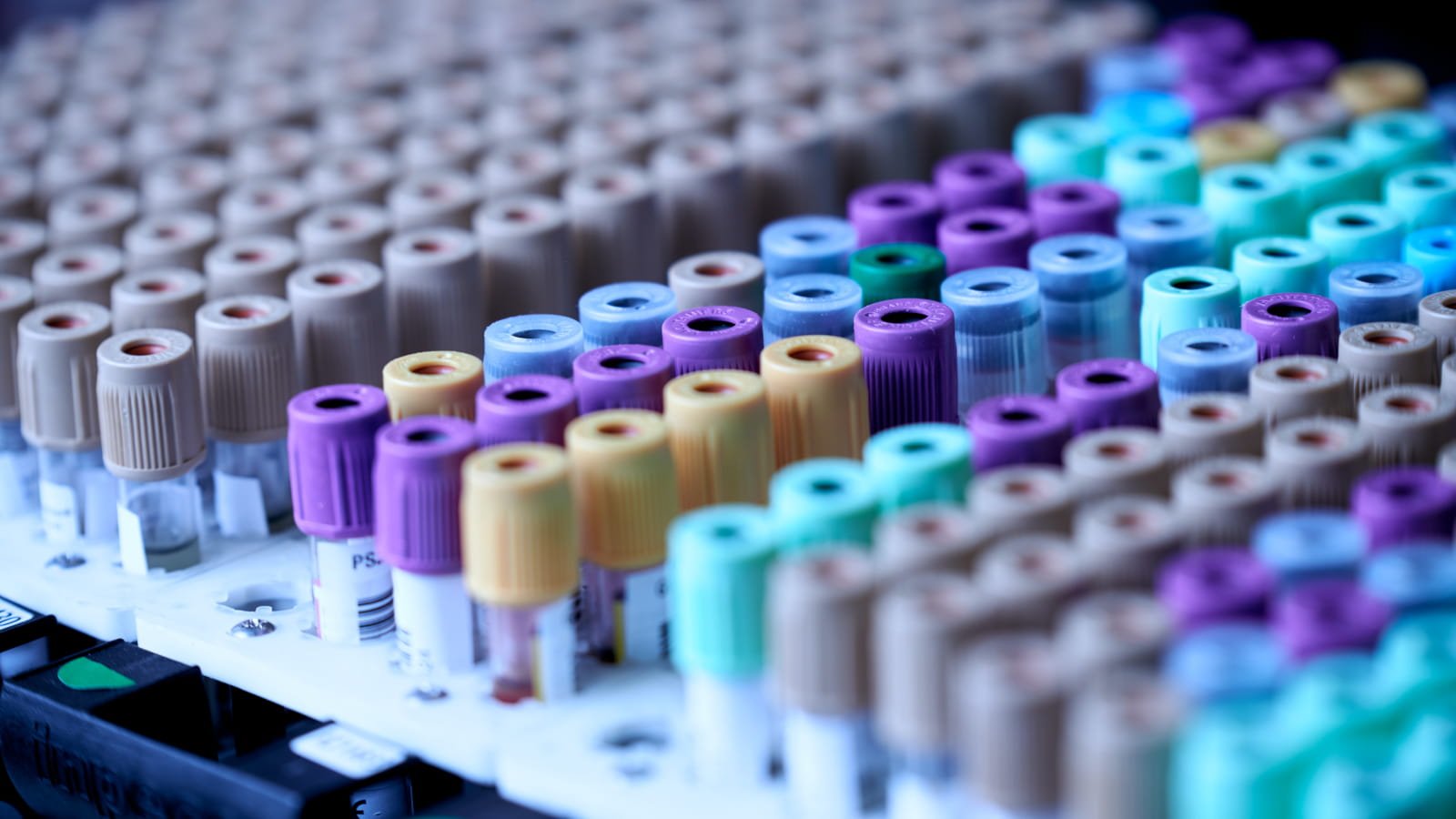 penyedia-pengujian-lab-as-mengekspos-data-kesehatan-dari-1,6-juta-orang