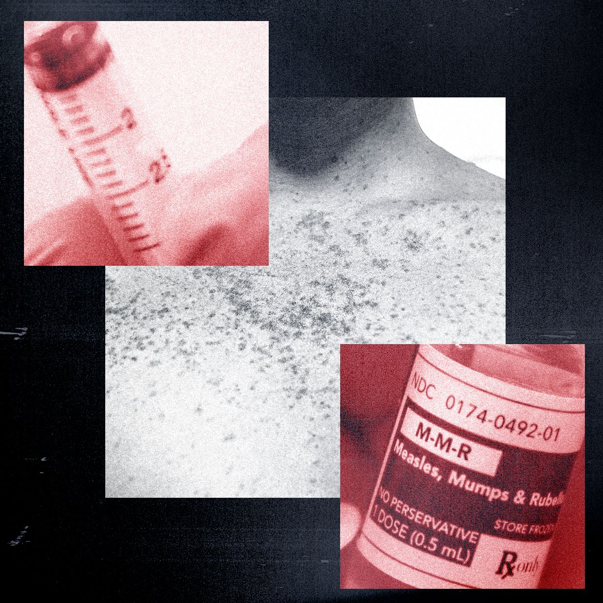 anti-vaxxers-grifting-dari-wabah-campak-dan-mengklaim-bioweapon-menyebabkannya