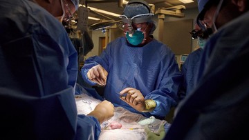 dokter-beberkan-tantangan-transplantasi-ginjal-di-indonesia