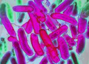 Bakteri Resisten Maju Lebih Cepat Dibandingkan Antibiotik
