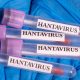 mengapa-wabah-kapal-pesiar-hantavirus-tidak-mungkin-menjadi-krisis-global