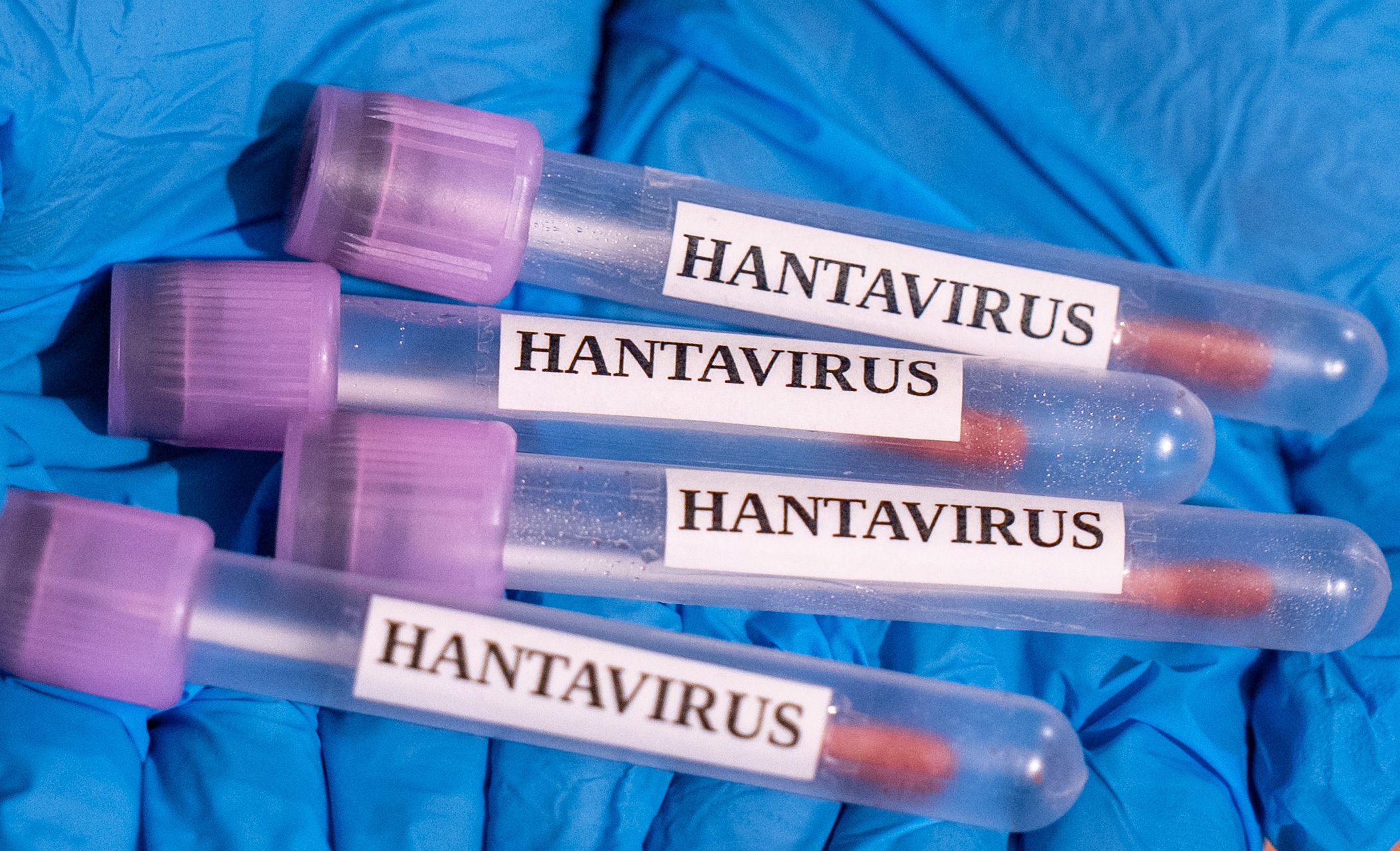 mengapa-wabah-kapal-pesiar-hantavirus-tidak-mungkin-menjadi-krisis-global