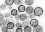 brin-jelaskan-risiko-penularan-hantavirus-usai-temuan-kasus-di-dki