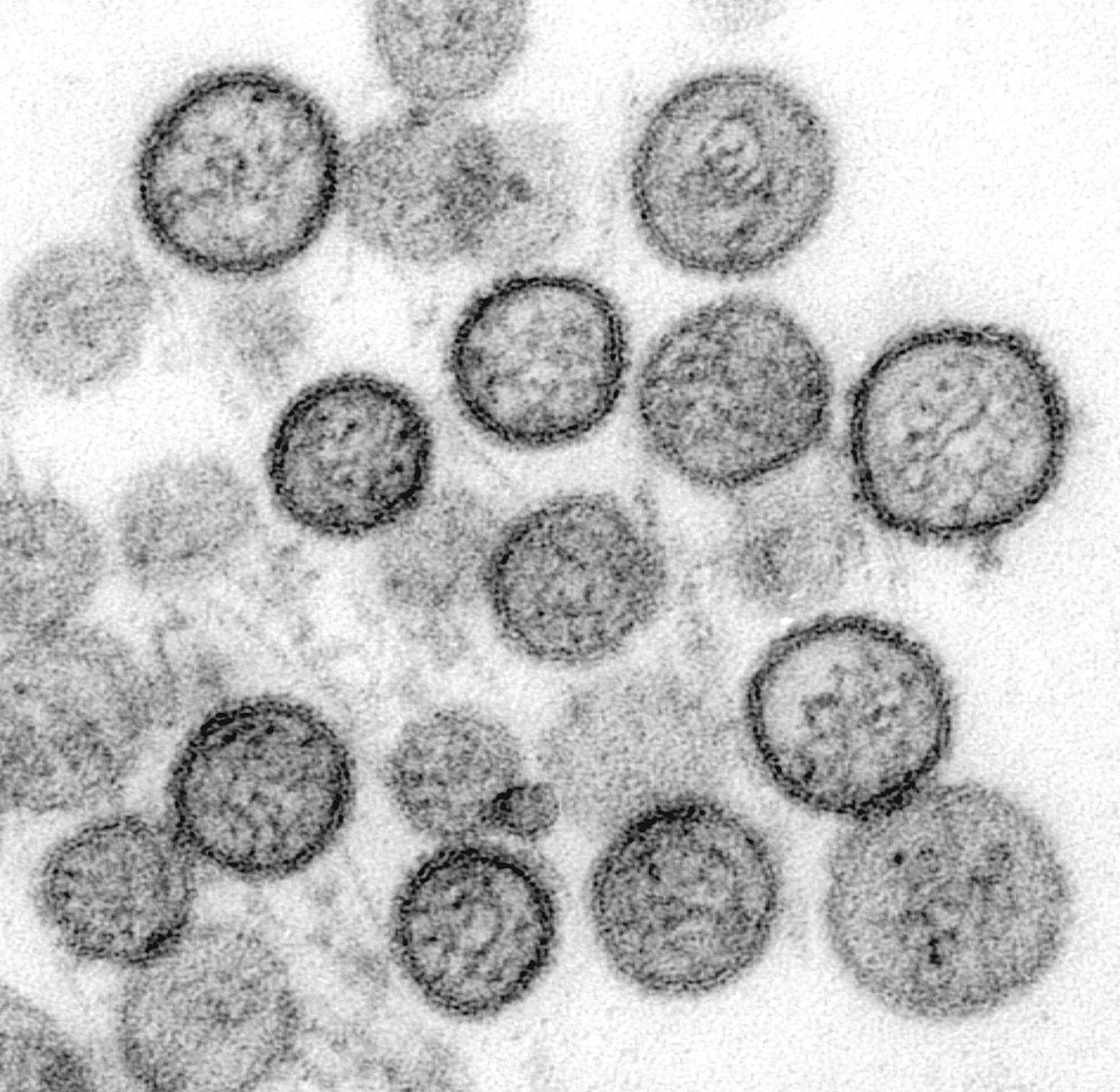 brin-jelaskan-risiko-penularan-hantavirus-usai-temuan-kasus-di-dki