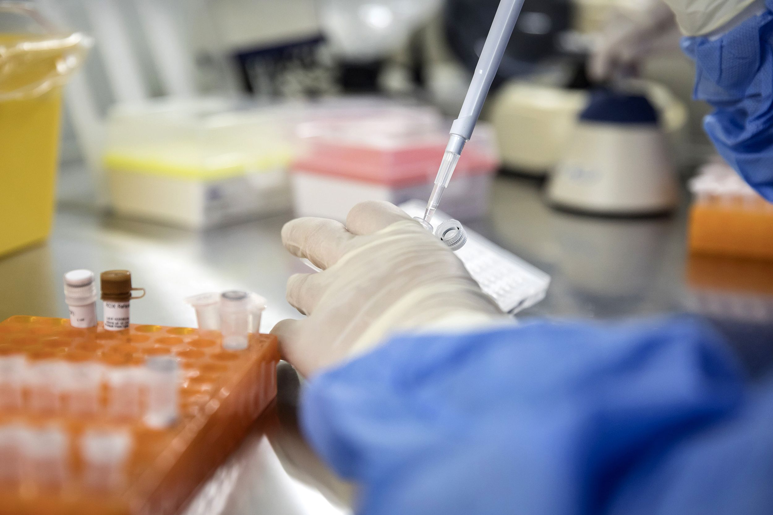 meningkatkan-sel-kekebalan-tubuh-dapat-membantu-mengendalikan-hiv-dalam-jangka-panjang