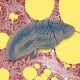 there’s-a-fatty-liver-epidemic.-ai-could-help-get-ahead-of-it