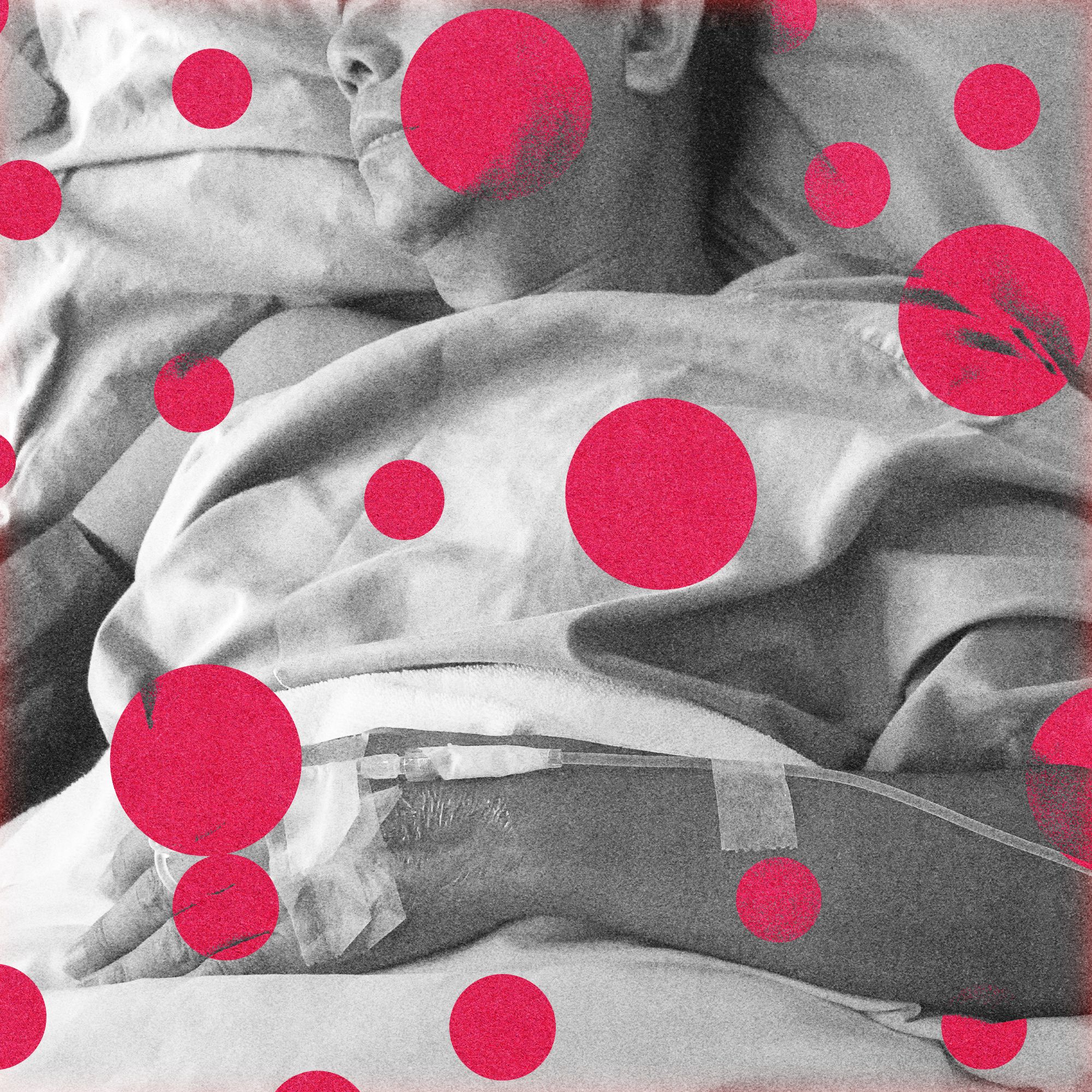 the-us-just-recorded-its-first-2-measles-deaths-this-year