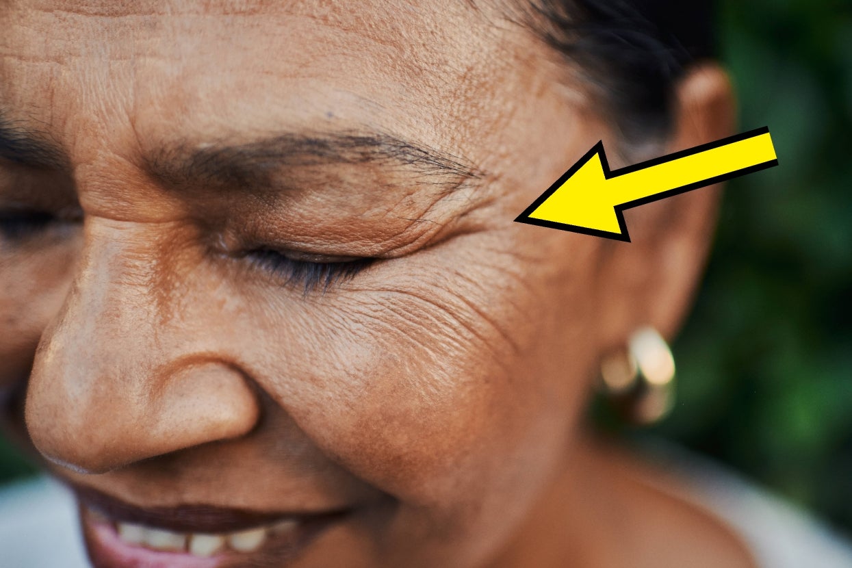 so-that’s-why-your-skin-gets-crepey-as-you-get-older