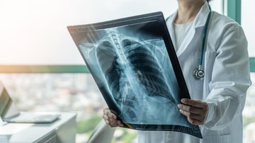 kadar-mikroplastik-tinggi-pada-pasien-kanker-paru-paru,-akibat-polusi?