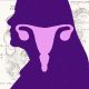 the-ovary-is-surprisingly-active-after-menopause.-scientists-are-trying-to-figure-out-why