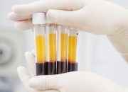 kemenkes-siapkan-regulasi-untuk-kembangkan-ekosistem-plasma