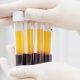 Kemenkes Siapkan Regulasi untuk Kembangkan Ekosistem Plasma