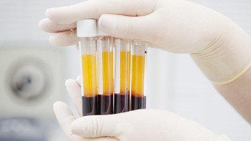 kemenkes-siapkan-regulasi-untuk-kembangkan-ekosistem-plasma