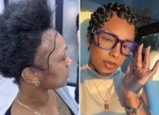 i-couldn’t-afford-a-$13,000-hair-transplant-in-the-us-so-i-flew-to-turkey-and-i-love-the-results.