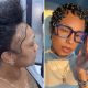 I couldn’t afford a $13,000 hair transplant in the US. So I flew to Turkey and I love the results.
