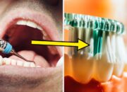 9-things-dentists-would-never,-ever-do-to-their-teeth
