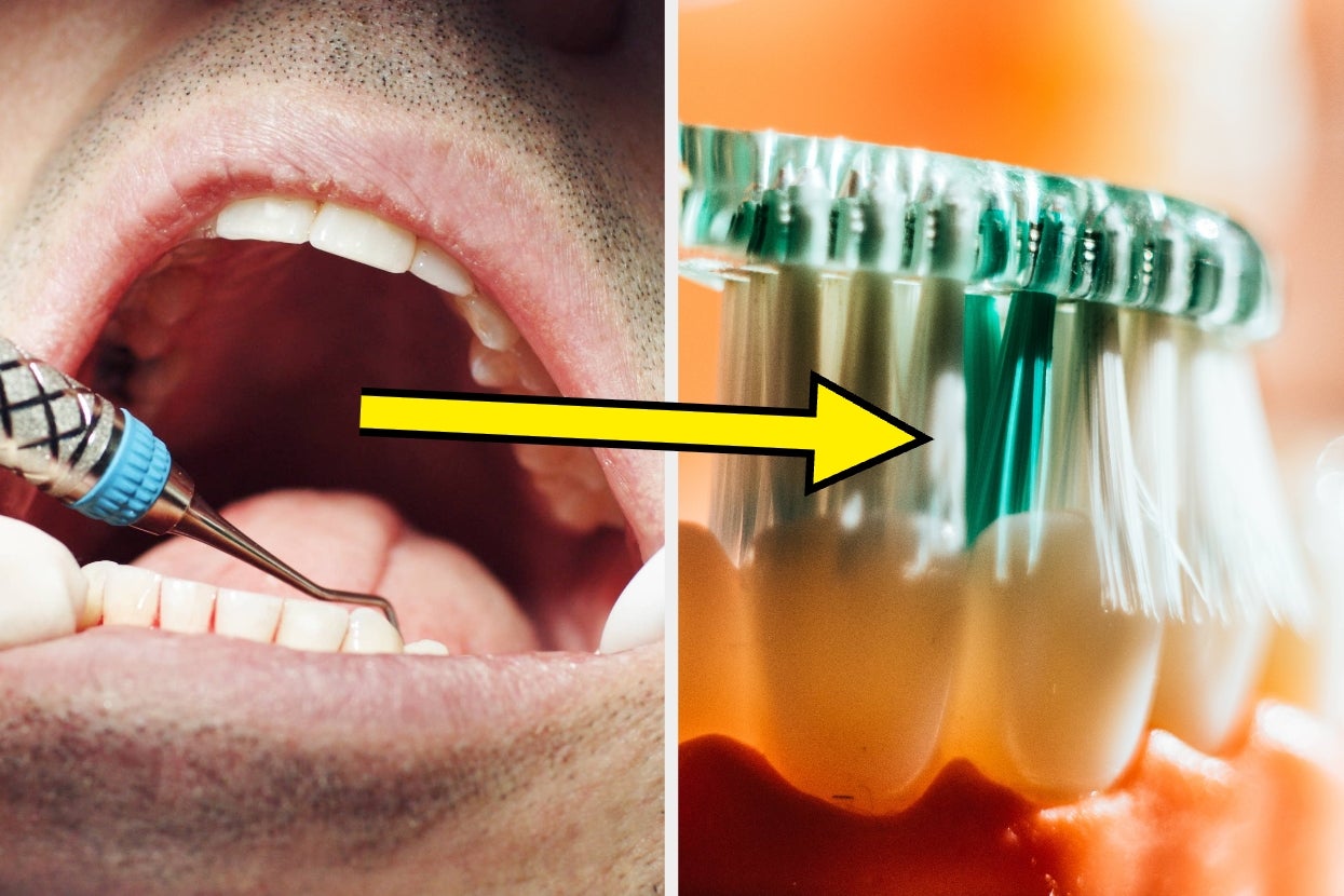 9-things-dentists-would-never,-ever-do-to-their-teeth